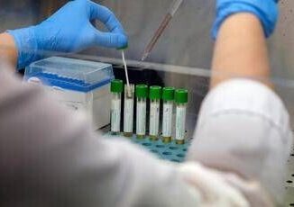 Mers 9 casi con due morti in Arabia Saudita. Oms Rischio moderato