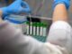 Mers 9 casi con due morti in Arabia Saudita. Oms Rischio moderato