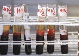Salute da Hiv a infezioni sessuali lotta a sommerso al via settimana europea test
