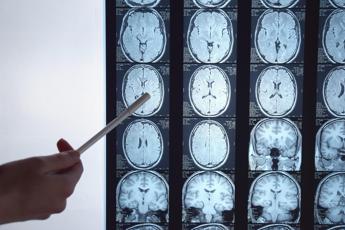 Un’ameba nel cervello dopo lavaggi nasali sbagliati, 10 casi negli Usa