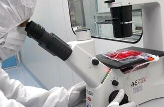 Car-T contro malattie autoimmuni, Bambino Gesù tratta primi 3 pazienti 3 Car T contro malattie autoimmuni Bambino Gesu tratta primi 3 pazienti