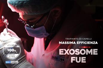 Este Capelli offre i risultati più efficaci grazie all’innovativo metodo di trapianto Exosome