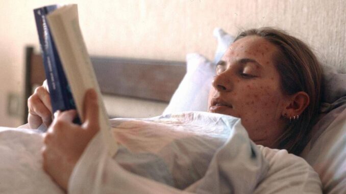 Morbillo, casi raddoppiati da aprile a maggio: “Dato preoccupante”