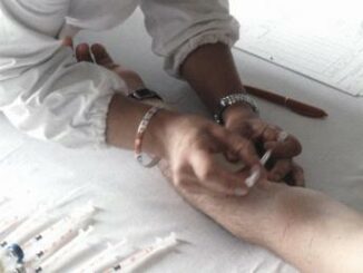 Allergia al nickel in aumento, l'immunologo "nuoce al 10% della popolazione" 5 Allergia al nickel in aumento limmunologo nuoce al 10 della popolazione