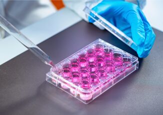 I nani superlongevi dell'Ecuador hanno il cuore protetto, lo studio 3 I nani superlongevi dellEcuador hanno il cuore protetto lo studio