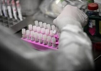 Aviaria un caso umano di H5N1 in Gran Bretagna ceppo diverso da quello Usa