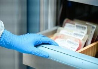Leucemia linfatica cronica studio italiano su terapie avanzate per over 80