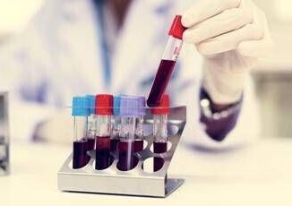 Cancro infantile un prelievo di sangue predira evoluzione ed efficacia cure