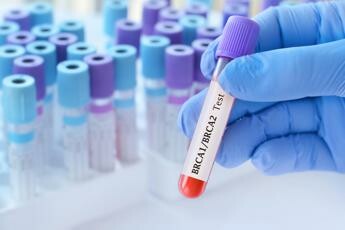 Cancro seno con mutazione Brca, 88% pazienti trattati con Olaparib è vivo a 6 anni