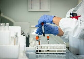 Malattia Congo Oms 406 casi piu di una patologia puo contribuire a morte