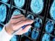 Sogni scudo anti Alzheimer Ritardo sonno Rem possibile spia precoce malattia