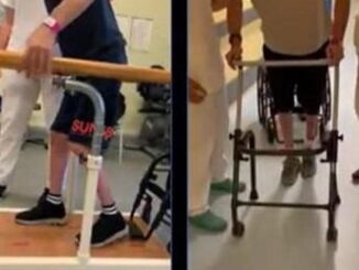 Neurostimolatore midollare fa tornare a camminare due pazienti, è la prima volta 3 Neurostimolatore midollare fa tornare a camminare due pazienti e la prima volta