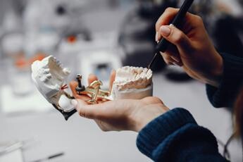 Qualità dell’osso per gli impianti dentali: Cosa sapere