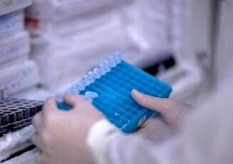 Colite ulcerosa nuovi risultati positivi da monoclonale guselkumab