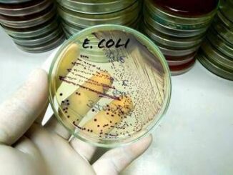 Da salmonella a listeria a E.Coli ipotesi in campo in tossinfezioni alimentari