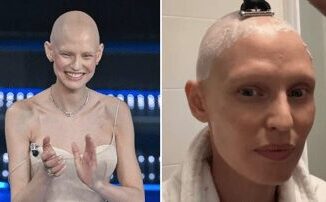Bianca Balti nuova terapia contro il tumore Per riparare il Dna danneggiato