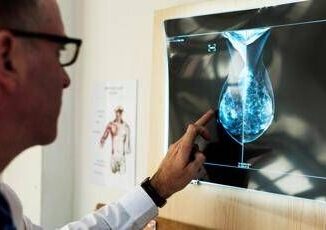 Cancro al seno crioablazione nuova frontiera di cura