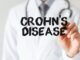 Farmaci Ue approva ampliamento indicazione mirikizumab in malattia di Crohn