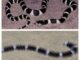 Italgam disponibile anche online lo scovolo Evo Snake contro i piccioni