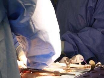 Roma muore a 62 anni dopo liposuzione in una clinica privata