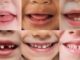 Salute Orale lAbc della prevenzione si impara in famiglia