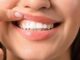 Salute in 70 persone con autismo problemi a denti e gengive parodontologi in campo