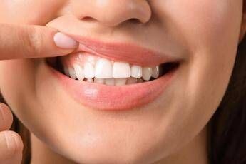 Salute ‘in 70% persone con autismo problemi a denti e gengive’, parodontologi in campo