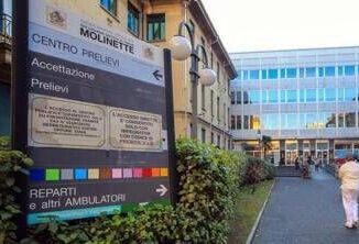 Torino intervento regala occhi nuovi a due fratelli nati senza iride
