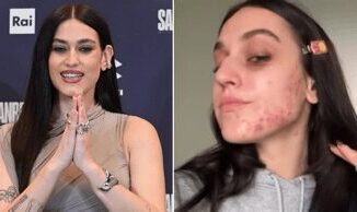 Gaia senza filtri mostra lacne sul viso Ho pensato di nascondermi voglio normalizzare