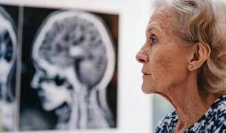 Giornata salute donne, Sin 'prendetevi cura anche della salute neurologica' 2 Giornata salute donne Sin prendetevi cura anche della salute neurologica