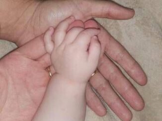 Roma salvata neonata da tumore con tecnica mini invasiva su misura