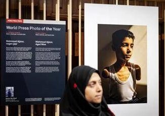 World Press Photo nella foto dellanno un bambino mutilato a Gaza