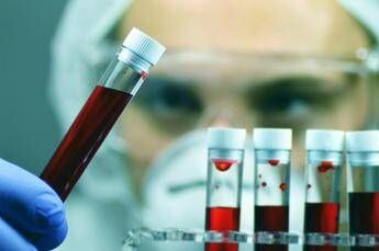 Alzheimer, Sin: “Test del sangue svolta epocale per diagnosi tempestive e cure mirate”