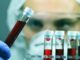 Tumori Ue approva terapia per adulti con leucemia linfatica cronica refrattaria