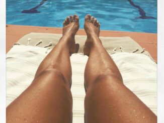Abbronzarsi con la vitiligine le regole del sole sicuro