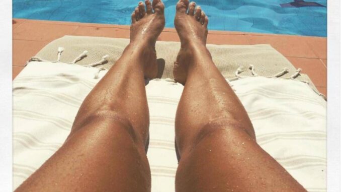 Abbronzarsi con la vitiligine, le regole del sole sicuro