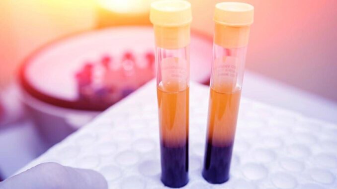 Farmaci, Sava (Sif Magazine): “In plasmaderivati attenzione particolare a sicurezza”