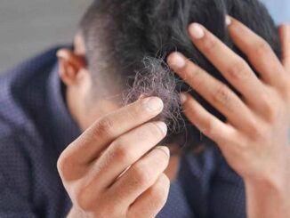 Il dermatologo Con alopecia areata disagi e costi alti svecchiare linee guida