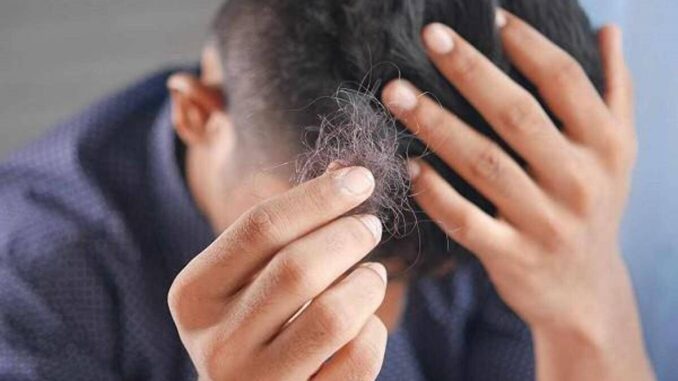 Il dermatologo: “Con alopecia areata disagi e costi alti, svecchiare linee guida”