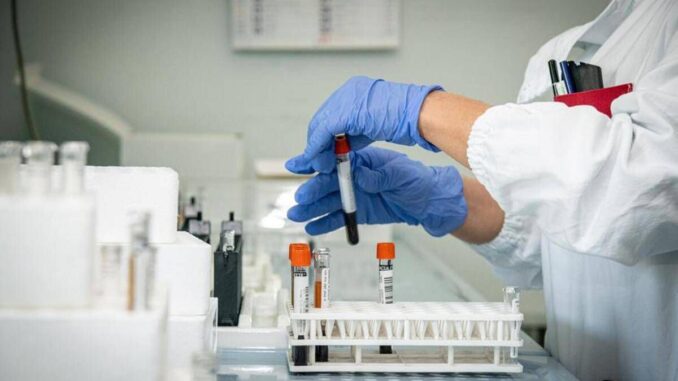 Mielofibrosi, ematologo: “Con uso precoce momelotinib maggiore sopravvivenza”