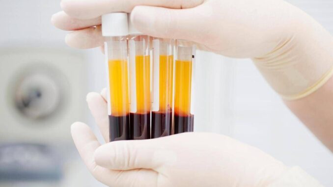 Plasmaderivati, Lecci (Sda Bocconi): “Serve un’innovazione rapida meno costosa”