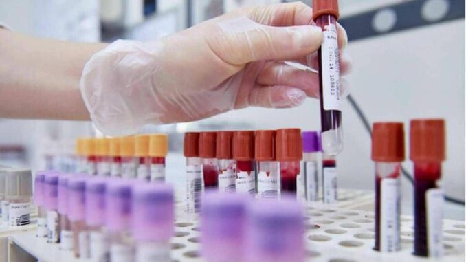 Sibioc, su ipotesi Regione Lazio: “No esternalizzazione medicina di laboratorio”