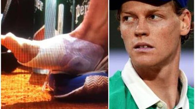 Sinner, problema vesciche al Roland Garros. Il precedente a Roma